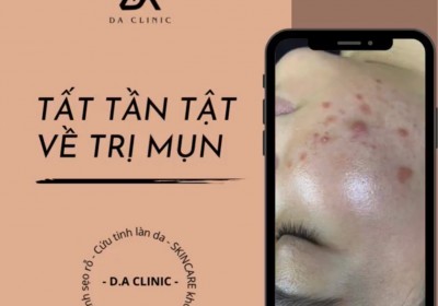 MỤN - THẤU HIỂU TRƯỚC - ĐIỀU TRỊ SAU
