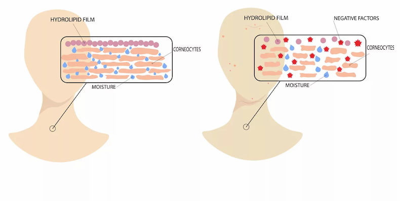 Cách khôi phục lớp màng Hydrolipid khi bị tổn thương